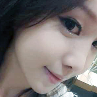 硅膠假體植入隆鼻兩個月了，分享手術過程和前后對比果圖片~