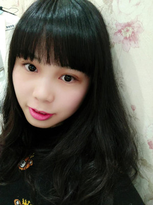 開內(nèi)眼角+雙眼皮手術(shù)后，我也變成大眼睛妹紙了