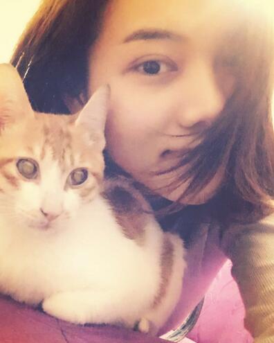 全切雙眼皮恢復(fù)1個(gè)月過(guò)程圖