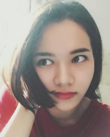 全切雙眼皮恢復(fù)1個(gè)月過(guò)程圖