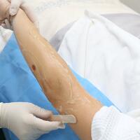 從小我就毛發(fā)旺盛，做了激光脫毛果圖分享給大家