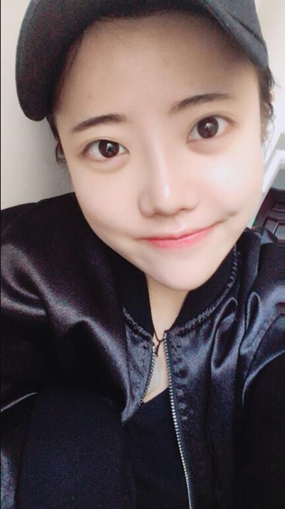 我的隆鼻整形恢復前后對果圖 一個字帥