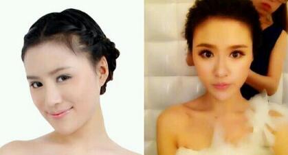 磨骨后下頜角恢復好后，覺得果很好，我又去做了鼻部整形，墊了下吧