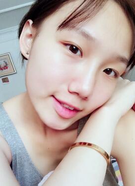 注射玻尿酸隆鼻第三天