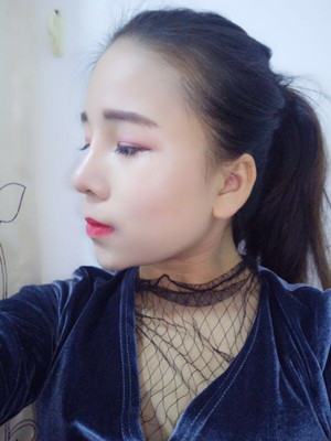 廣州廣美做的假體隆鼻，給大家分享一下手術(shù)前后過程以及對比照片