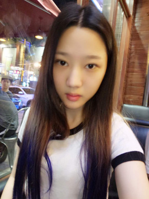 切開雙眼皮+假體隆下巴，我不再是典型的路人甲