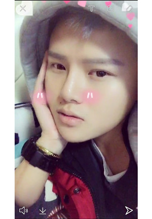 玻尿酸隆鼻+墊下巴親身經(jīng)歷~~果不錯(cuò)哦