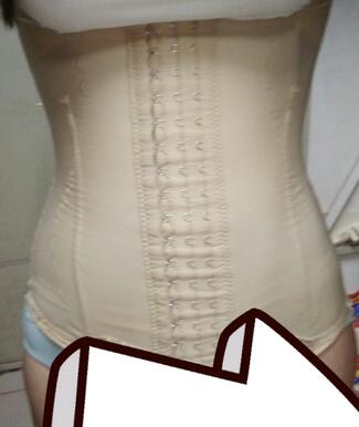 腰腹抽脂3個月的感受