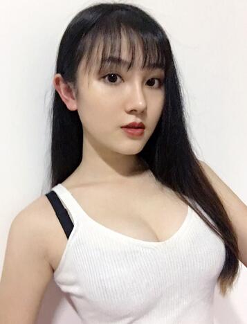 重慶好美自體脂肪隆胸已經一個月了