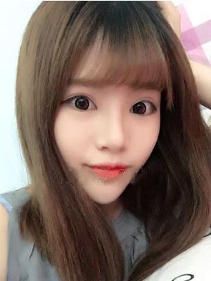 耳軟骨墊鼻尖+硅膠假體隆鼻前后對比，變化是不是很大