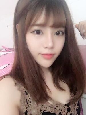 耳軟骨墊鼻尖+硅膠假體隆鼻前后對比，變化是不是很大