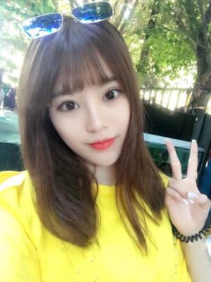 耳軟骨墊鼻尖+硅膠假體隆鼻前后對比，變化是不是很大