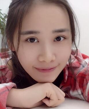 割雙眼皮一個半月了，雙眼皮完全恢復自然