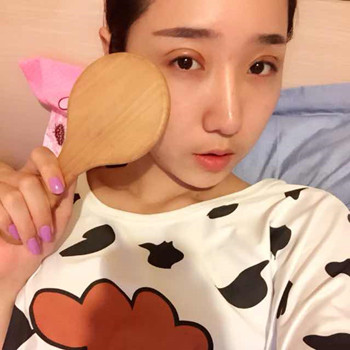 歐式大雙眼皮的恢復過程分享哦