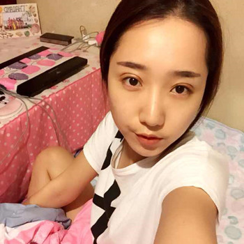 歐式大雙眼皮的恢復過程分享哦