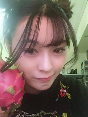 自體脂肪填充全臉，我也可以美美噠