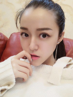 真人記錄了8周全切雙眼皮手術過程，還有對比照片喲