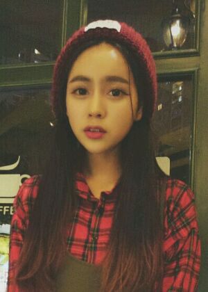 自體脂肪豐額頭+蘋果肌恢復(fù)兩個月照片分享