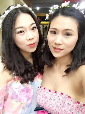 做完高強(qiáng)度聚焦超聲之后都說我變漂亮了