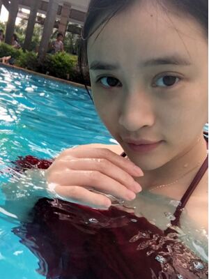 雙眼皮失敗修復(fù)之后疤痕完全沒(méi)有啦