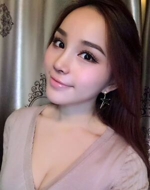 隆鼻整形+硅膠墊下巴前后對比照片給大家瞅瞅