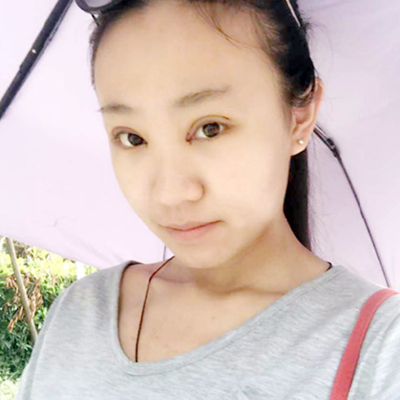 雙眼皮+開眼角術(shù)后三個(gè)月左右的果照片分享哦~