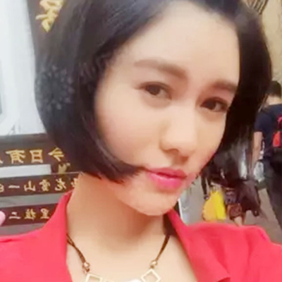 玻尿酸注射鼻子+下巴+太陽(yáng)穴+蘋果肌術(shù)后一個(gè)月的果照片~