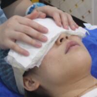 去眼袋手術(shù)多少錢？做了激光去眼袋價(jià)格5800元，恢復(fù)很好