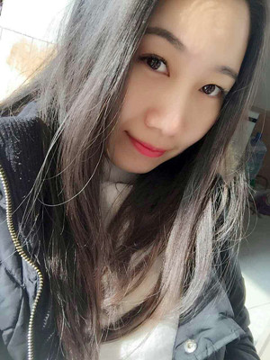 自體脂肪豐面頰，見證我蝶變的過程