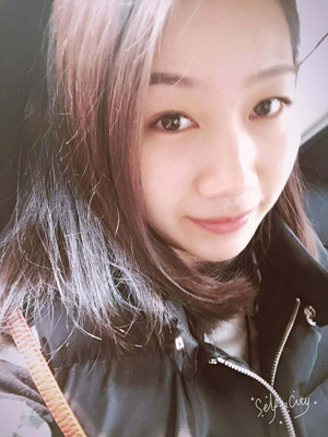 自體脂肪豐面頰，見證我蝶變的過程