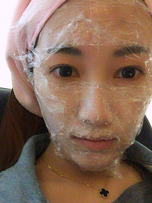 光子嫩膚真實(shí)案例分享，果真的還不錯(cuò)哦!