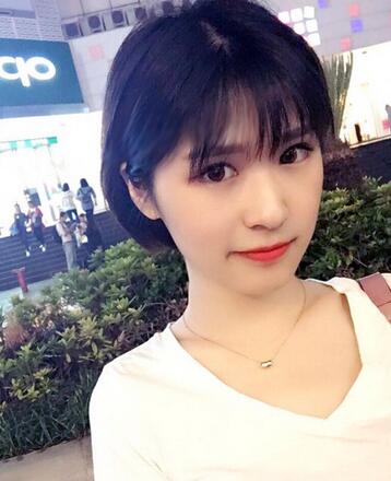 微創(chuàng)定點(diǎn)每天恢復(fù)過程圖 北京麗星雙眼皮3個(gè)月