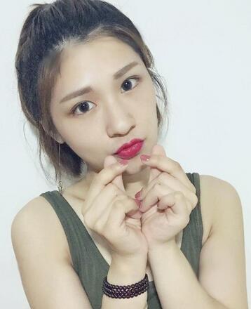 微創(chuàng)定點(diǎn)每天恢復(fù)過程圖 北京麗星雙眼皮3個(gè)月