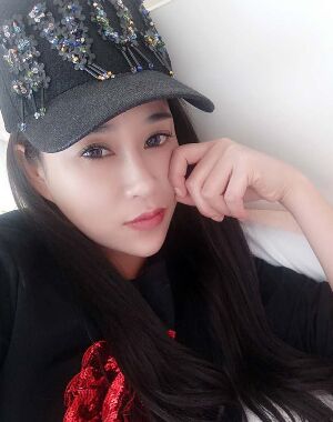 牛永敢做的隆鼻失敗修復(fù)，對比很明X哦~