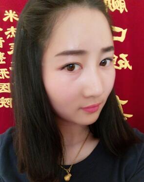 下圖是自體脂肪填充后