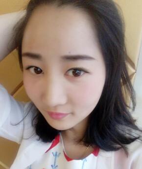 自體脂肪填充太陽穴+額頭第十天