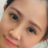 在昆明做了眼睛和鼻子整形，雖然花費(fèi)了16000元，但人美了就值！