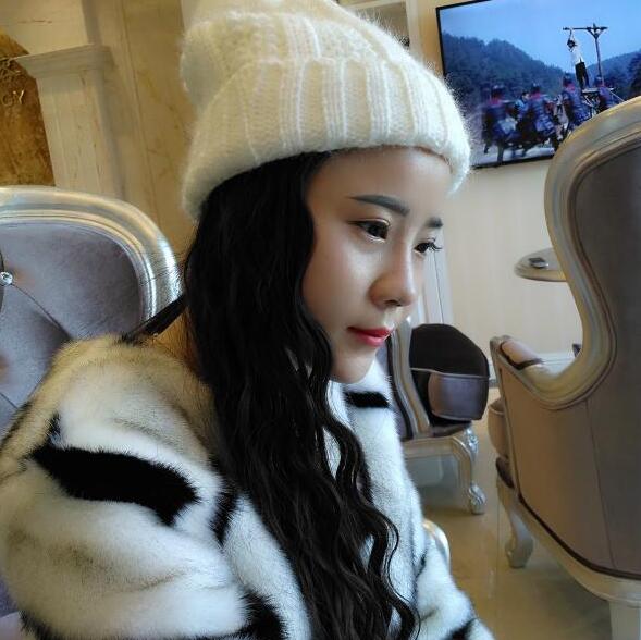 隆鼻整形前后恢復過程隆鼻梁+墊鼻尖整形果很好哦