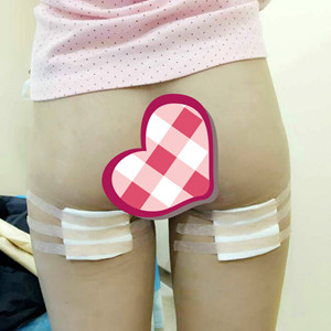 大腿吸脂，我也可以擁有小細(xì)腿