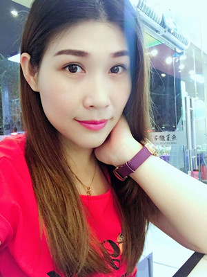 激光祛眼袋2個月，不用手術(shù)就可以變得很年輕哦！