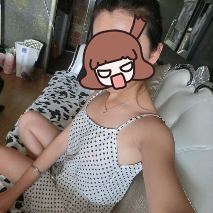 自體脂肪隆胸手術(shù)價(jià)格21800做的，恢復(fù)過程圖分享