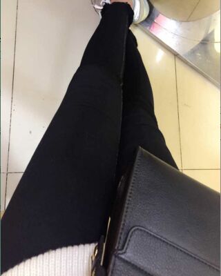 大腿抽脂的過程照片，瘦了一大圈呢