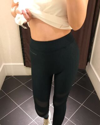 腰腹吸脂減肥真實案例，果好不反彈