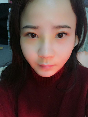 隆鼻整形前后對(duì)比變化真的不要太大哦