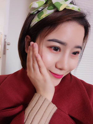 隆鼻整形前后對(duì)比變化真的不要太大哦