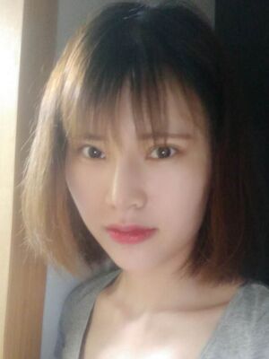 隆鼻整形真實(shí)恢復(fù)期圖片，大鼻子終于變秀氣了