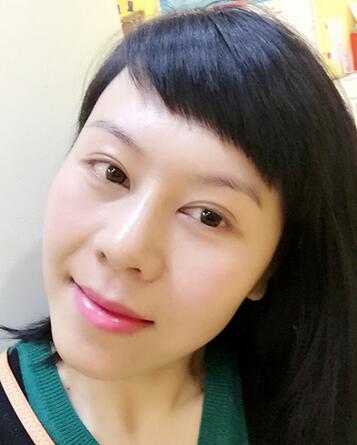 面部埋埋蛋白線.提升恢復(fù)過程分享