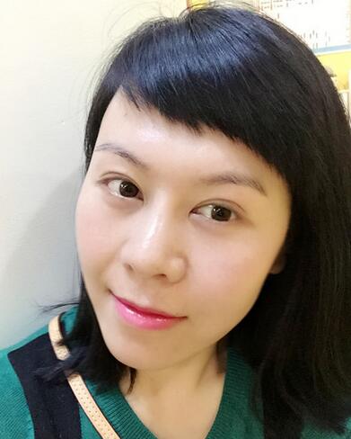 面部埋埋蛋白線.提升恢復(fù)過程分享