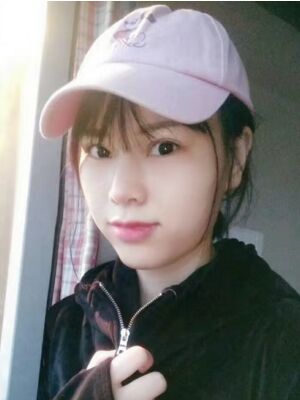 隆鼻整形真實(shí)恢復(fù)期圖片，大鼻子終于變秀氣了