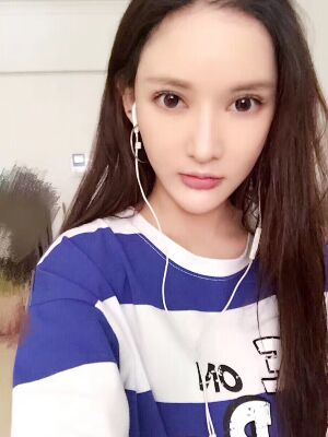 面部埋埋蛋白線.提升術(shù)后照片，皮膚緊致不少了